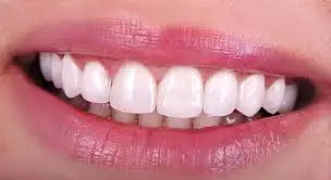 l 18 Ways Look Beautiful of Teeth l For Teeth Whitening l