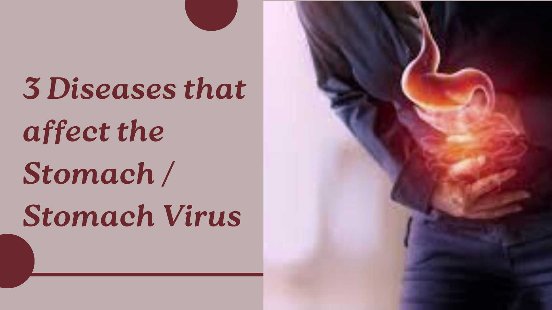 3 Diseases that affect the Stomach / Stomach Virus